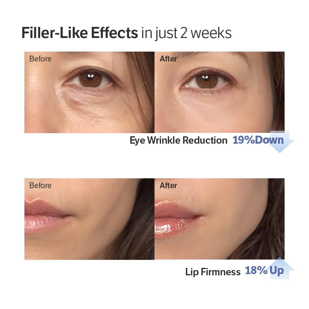 👉 Buy 1 Get 1 FREE – Limited Time Offer-HZA Volufiline-Infused Korean Collagen Serum