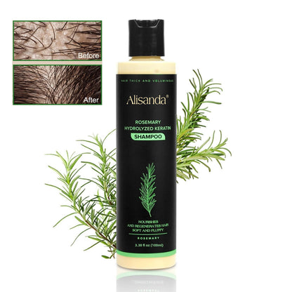 Buy 1 Get 1 FREE 🎁-Rosemary Shampoo | Hair Growth & Anti-Dandruff Scalp Treatment