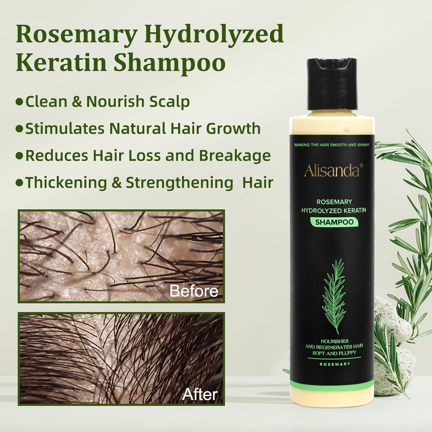 Buy 1 Get 1 FREE 🎁-Rosemary Shampoo | Hair Growth & Anti-Dandruff Scalp Treatment
