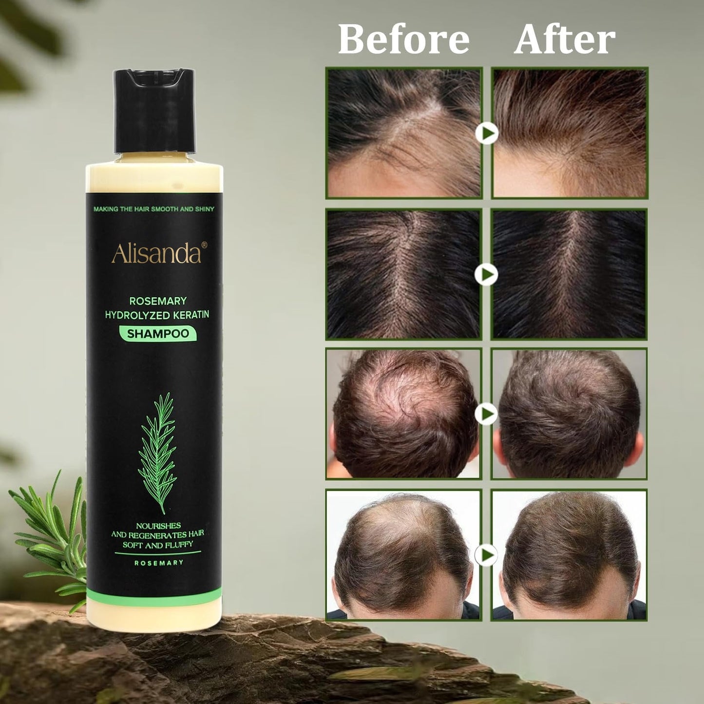 Buy 1 Get 1 FREE 🎁-Rosemary Shampoo | Hair Growth & Anti-Dandruff Scalp Treatment