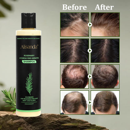 Buy 1 Get 1 FREE 🎁-Rosemary Shampoo | Hair Growth & Anti-Dandruff Scalp Treatment