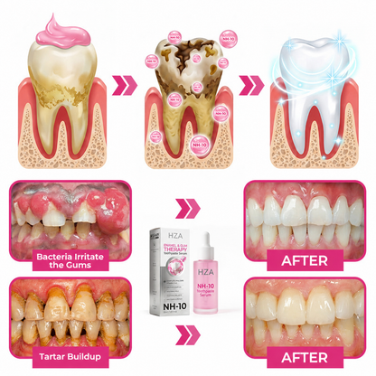 Thismile NH-10 Toothpaste Serum for Enamel and Gum Care – Advanced Therapy