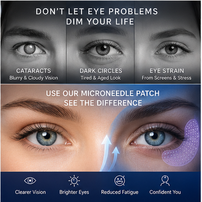 👍 BUY 1 GET 1 FREE-Transdermal Vision-Repair Eye Microneedle Patch