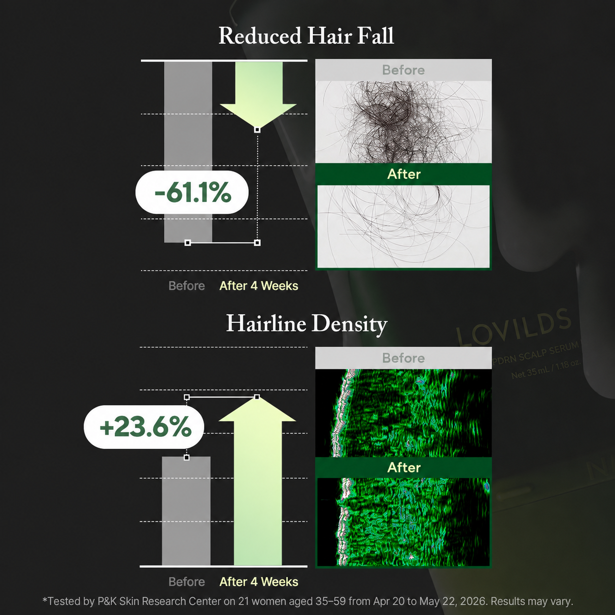 🌿 LOVILDS PDRN Scalp Serum | Root-Focused Care for Fuller, Healthier-Looking Hair ✨