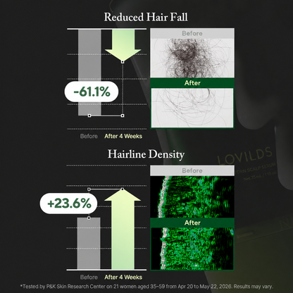 🌿 LOVILDS PDRN Scalp Serum | Root-Focused Care for Fuller, Healthier-Looking Hair ✨
