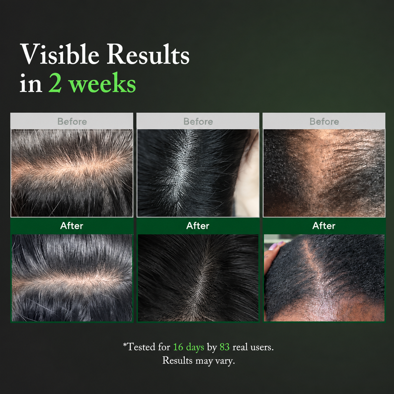 🌿 LOVILDS PDRN Scalp Serum | Root-Focused Care for Fuller, Healthier-Looking Hair ✨